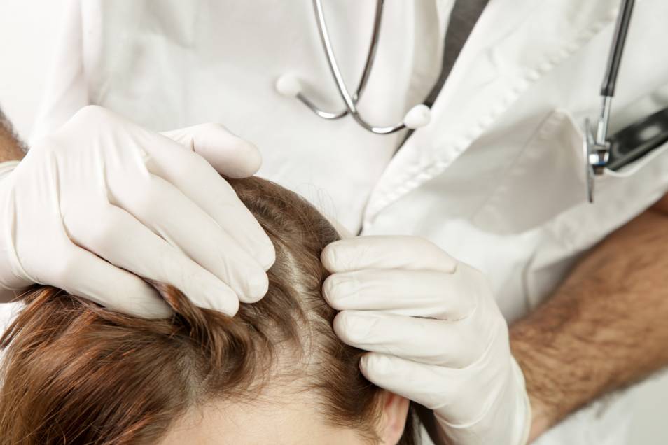 Un médecin portant des gants examine de près le psoriasis du cuir chevelu d'une patiente aux cheveux châtains.
